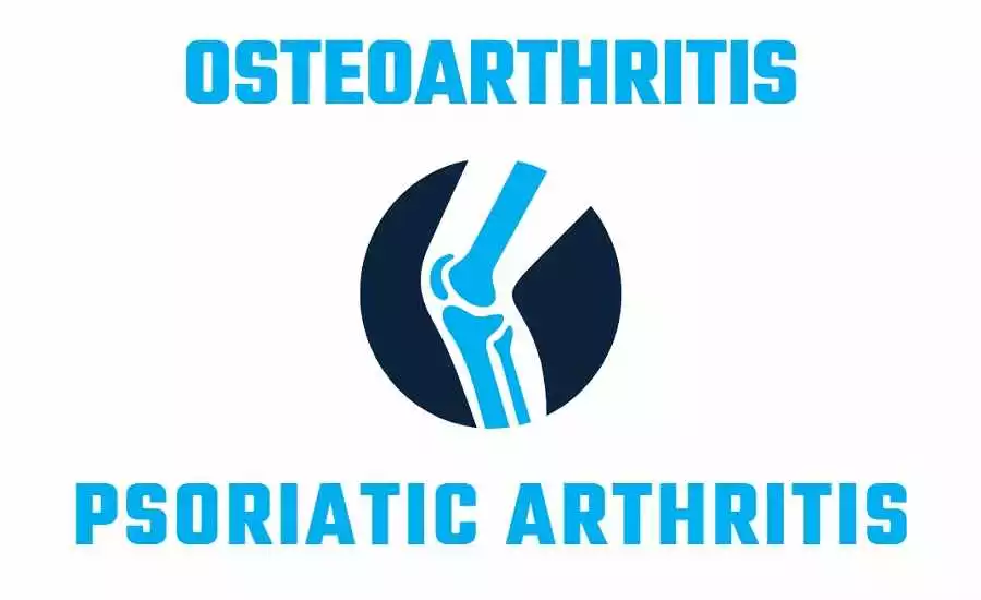 can osteoarthritis be mistaken for psoriatic arthritis