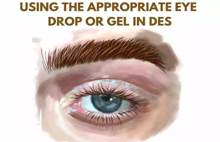 Dry Eye Syndrome: When To Use The Eye Drops For Dry Eyes
